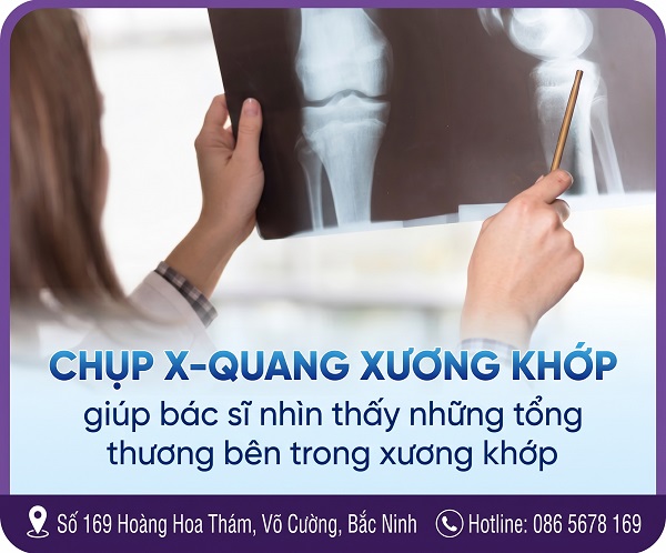 Chụp X-quang xương khớp có tác dụng gì? 5 Dấu hiệu cảnh báo bạn không nên chủ quan