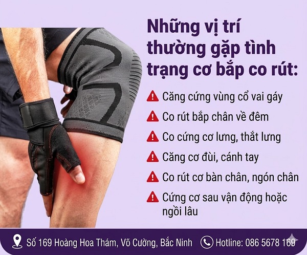 Cơ bắp căng cứng, co rút tái phát nhiều lần: Khi nào cần đi khám sớm?