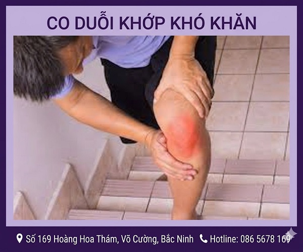 https://dakhoabacninh.com/wp-content/uploads/2026/05/co-duoi-khop-kho-khan.jpeg