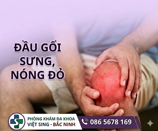 https://dakhoabacninh.com/wp-content/uploads/2026/05/dau-goi-sung-nong-do.jpeg