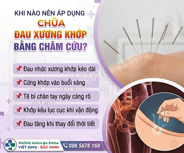 Châm cứu đau xương khớp – Giải pháp giảm đau được đánh giá cao