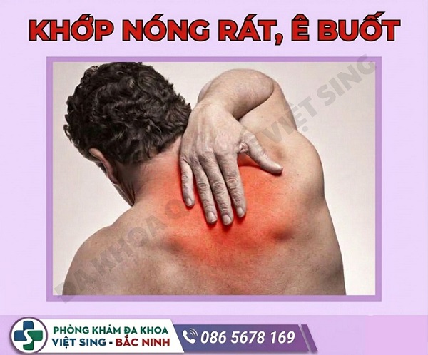 Giải mã hiện tượng nóng rát, ê buốt quanh khớp thường gặp hiện nay