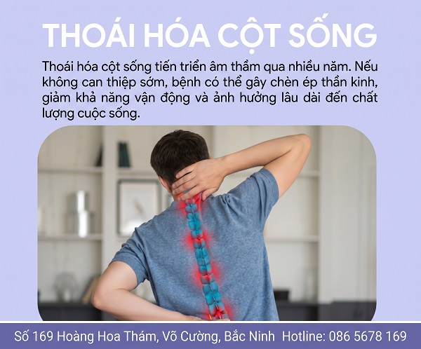 Thoái hóa cột sống: Căn bệnh âm thầm phá hủy khả năng vận động của bạn
