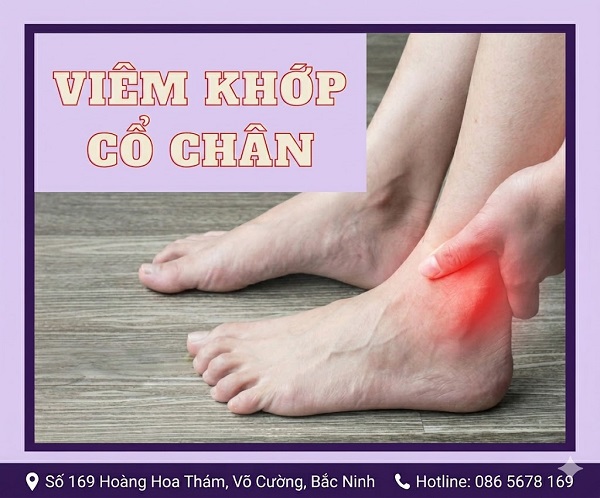 https://dakhoabacninh.com/wp-content/uploads/2026/05/viem-khop-co-chan.jpeg
