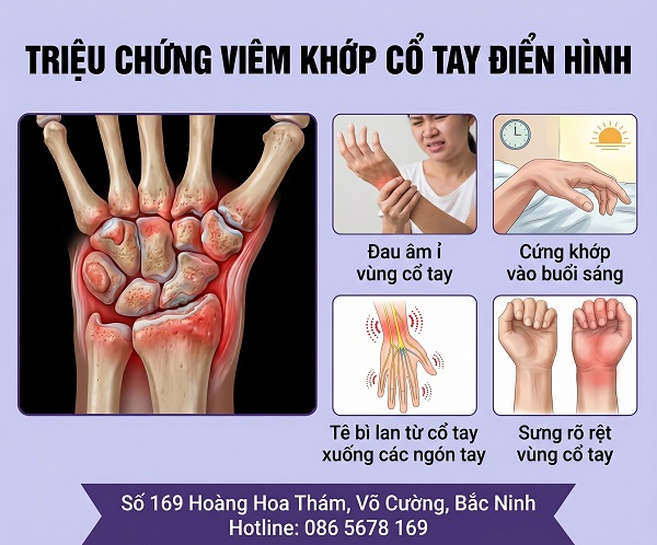 Viêm khớp cổ tay – Những thông tin cơ bản giúp bạn không bỏ lỡ “giai đoạn vàng” điều trị
