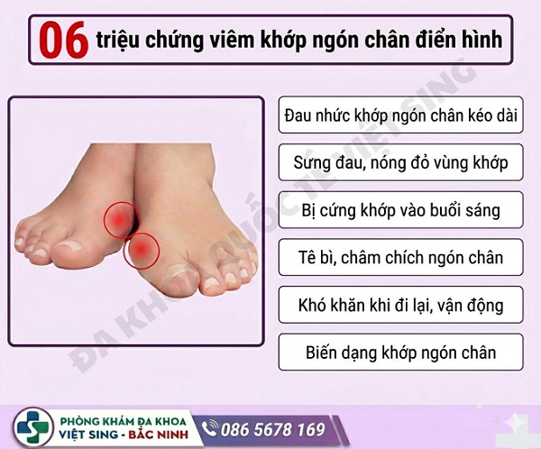 Cảnh báo: Viêm khớp ngón chân đang trẻ hóa từng ngày!