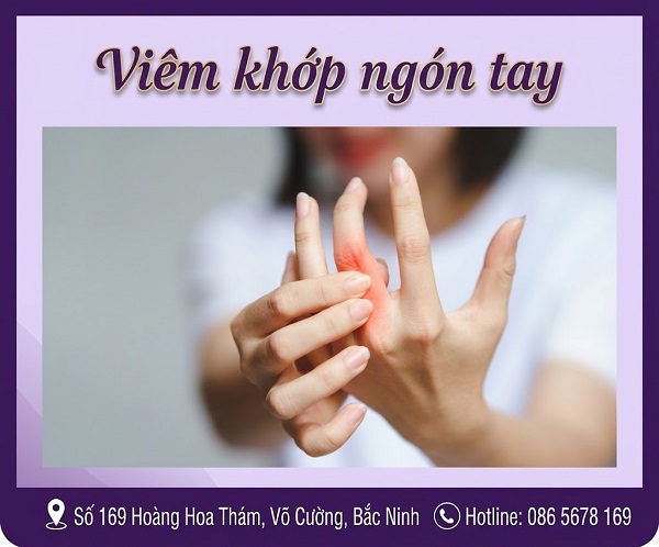Viêm khớp ngón tay và những dấu hiệu âm thầm phá hủy chức năng bàn tay