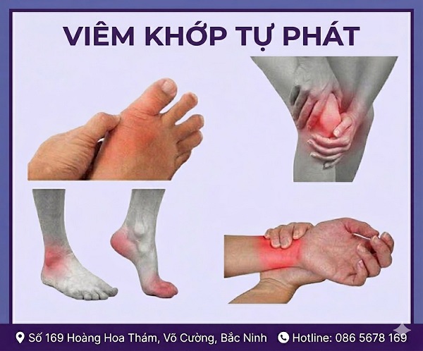 https://dakhoabacninh.com/wp-content/uploads/2026/05/viem-khop-tu-phat.jpeg