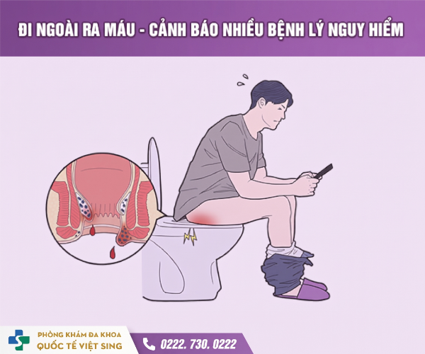 Đại tiện ra máu: Nhận biết nguyên nhân và thời điểm “vàng” cần đi khám ngay